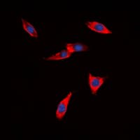 Polyclonal Rabbit anti-Human CDH22 / Cadherin 22 Antibody (Internal, IF, WB)