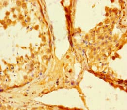 SMAD5 Antibody