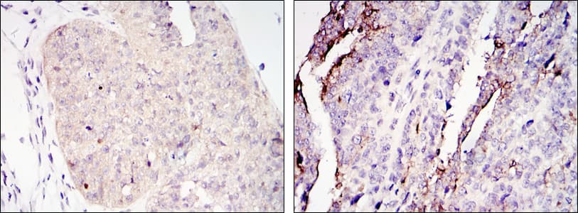 CRTC2 / TORC2 Antibody (clone 5B10)