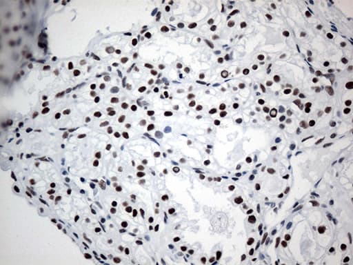 Monoclonal Mouse anti-Human GTF3C4 Antibody (clone OTI4A3, Carrier-free, aa583-822, IHC, WB)