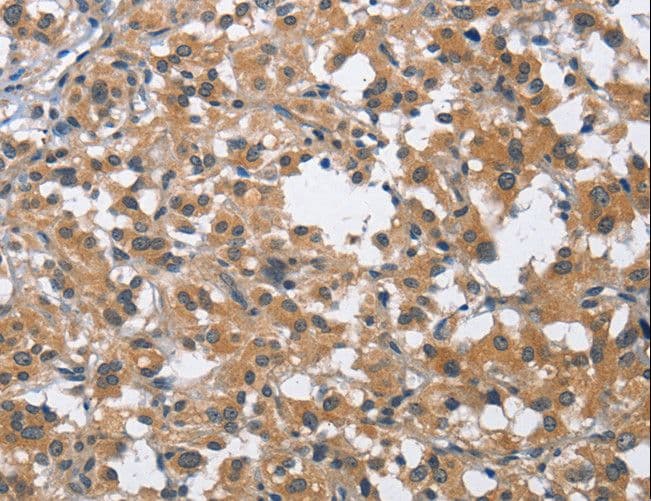 BUB1 Antibody