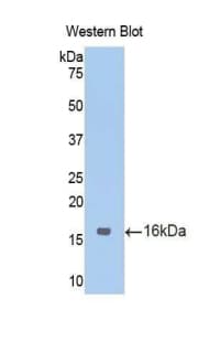 CD105 Antibody (aa27-137)