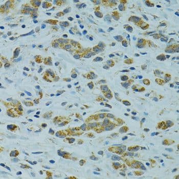 Polyclonal Rabbit anti-Human STX1A / Syntaxin 1A Antibody (IHC, WB)