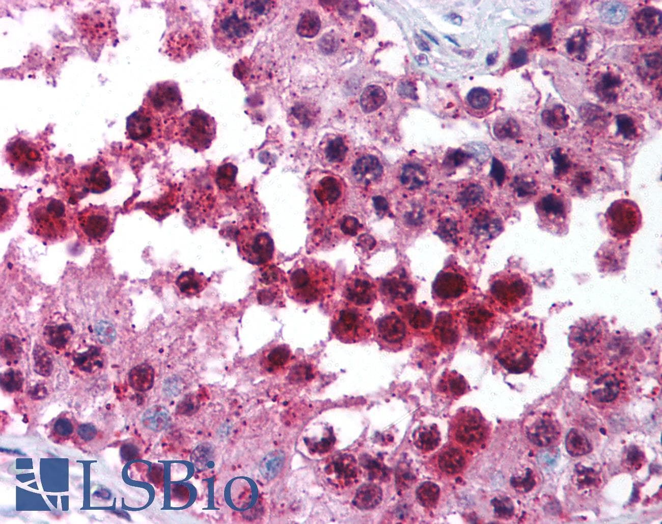 IHC-plus™ CUL9 / Cullin 9 Antibody