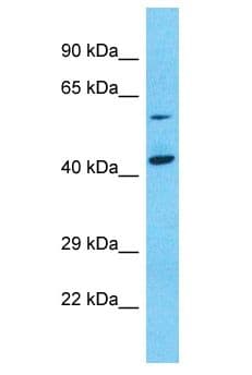 Polyclonal Rabbit anti-Human NPEPL1 Antibody (aa405-454, WB)