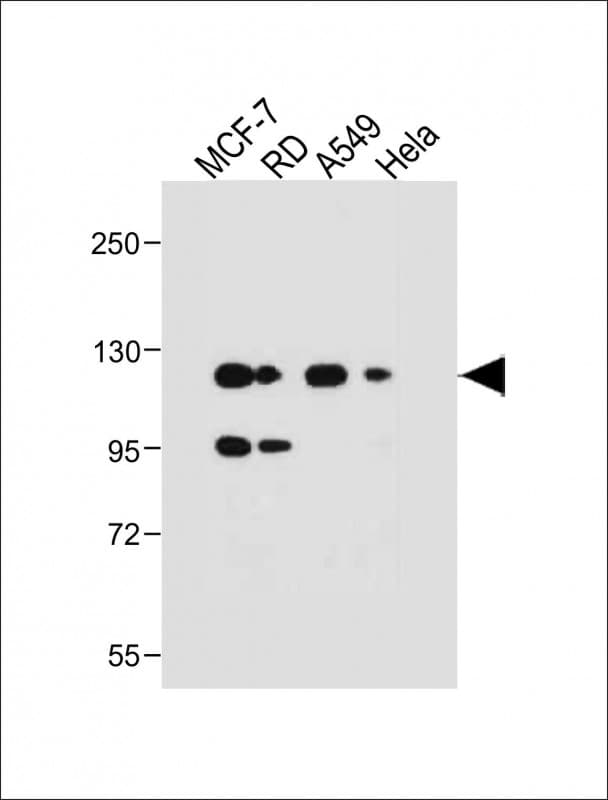 NRG1 / Heregulin / Neuregulin Antibody