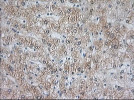 ACAT2 Antibody (clone OTI5A2)