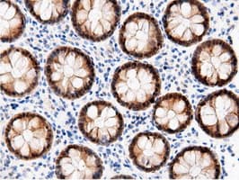 AK5 / Adenylate Kinase 5 Antibody (clone OTI2F9)