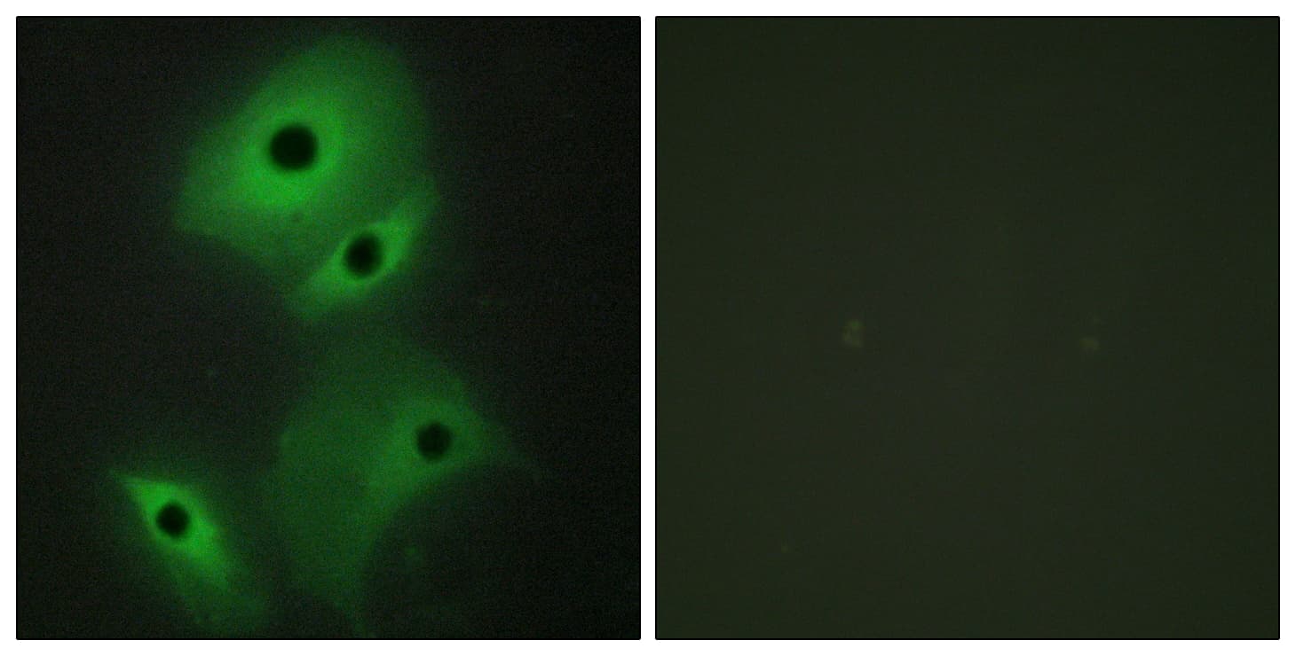 Polyclonal Rabbit anti-Human NBL1 / DAN Antibody (aa131-180, IHC, IF, WB)