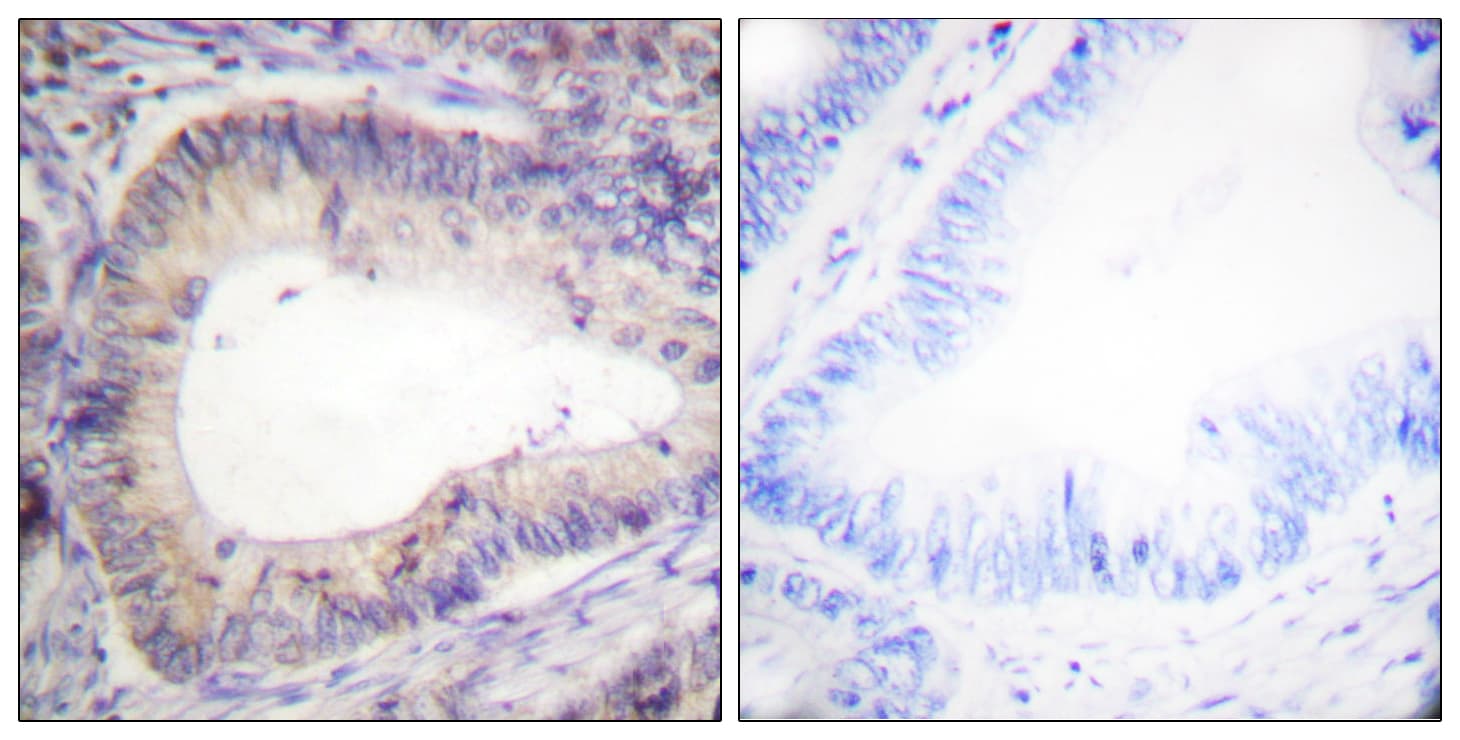 BCL2 / Bcl-2 Antibody (phospho-Thr69)