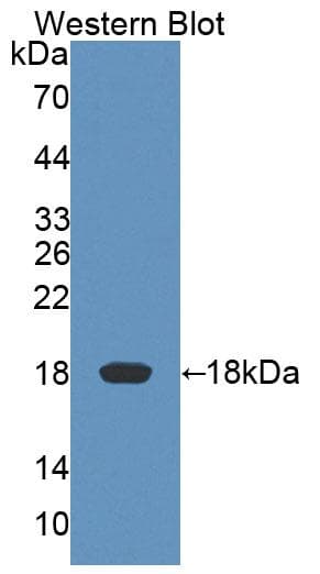 KLRK1 / CD314 / NKG2D Antibody (aa75-215)
