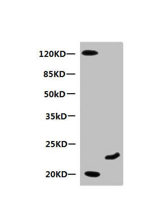 Monoclonal Mouse anti-Human MB / Myoglobin Antibody (clone 7A3D2, IHC, WB)