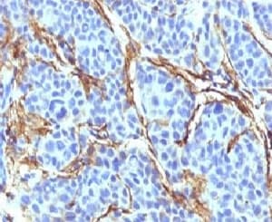 NGFR / CD271 / TNR16 Antibody (clone CDLA271)