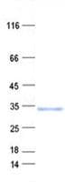 Human BTBD19 Protein (Recombinant His, N-Terminal)
