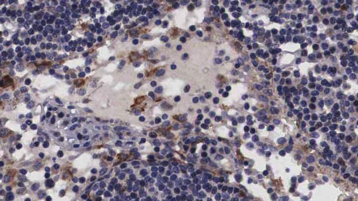Polyclonal Rabbit anti-Human NT5C3A Antibody (IHC, IF, WB)