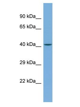 TRIM49C Antibody (aa51-100)