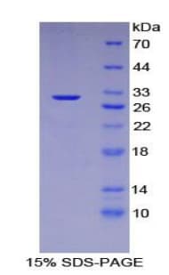 Human DES / Desmin Protein (Recombinant His-T7)