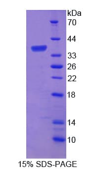 Human PTPRG / RPTR-Gamma Protein (Recombinant His-T7)