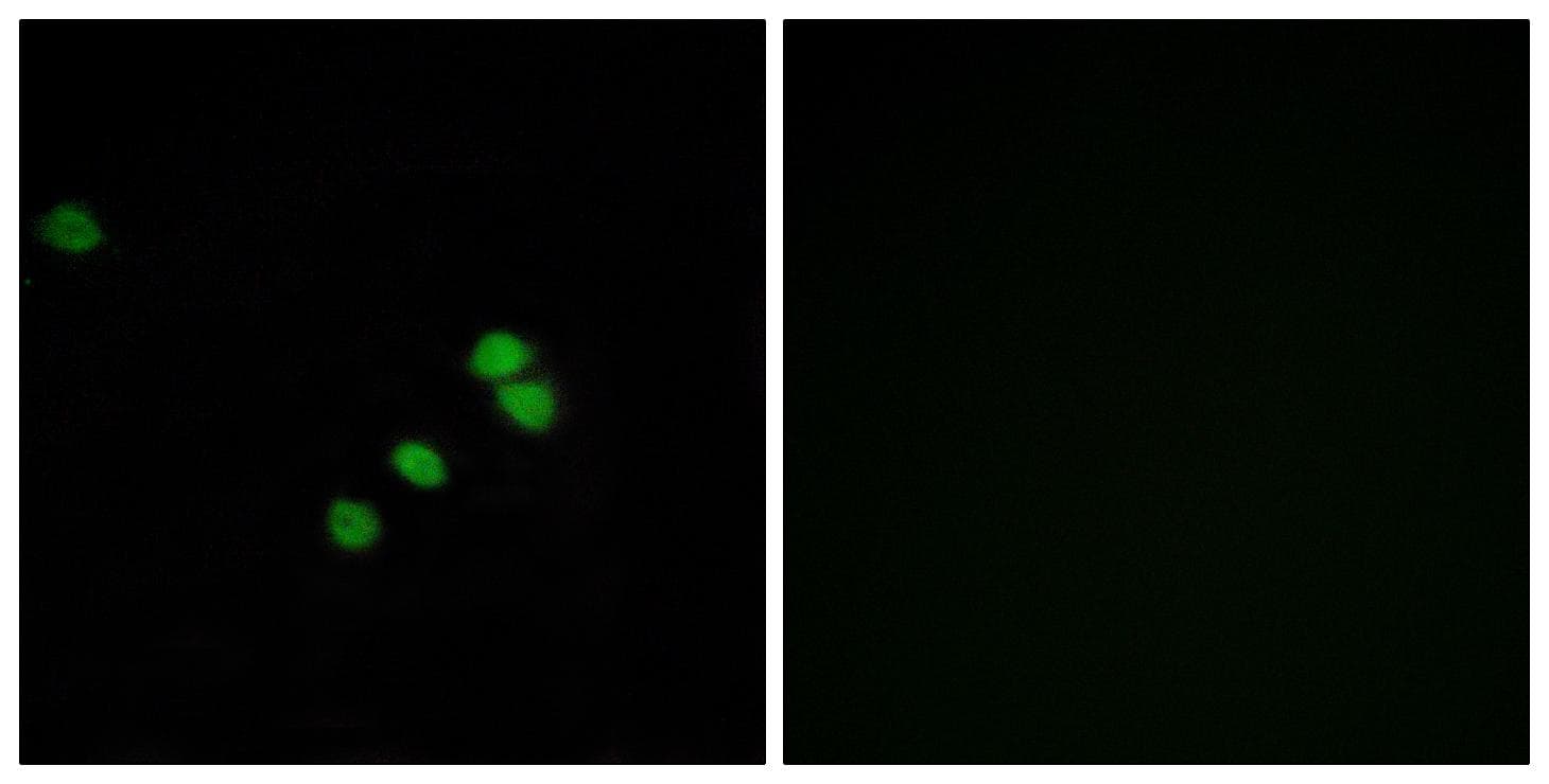SP1 Antibody (p739)
