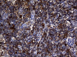 NME1 / NM23 Antibody (clone OTI2D8)
