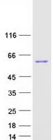 Human SMYD1 Protein (Recombinant Myc-DDK (Flag))