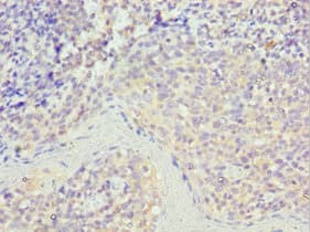 STK16 Antibody (aa1-305)