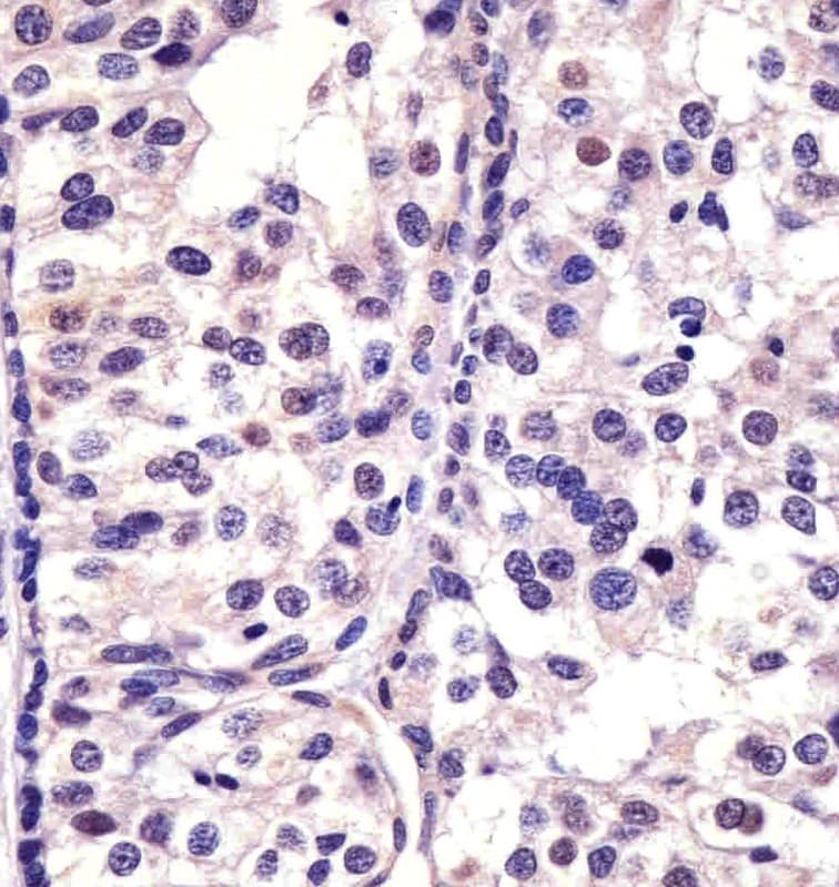 Monoclonal Mouse anti-Human CDK4 Antibody (clone 1529CT850.162.73, IHC, WB)
