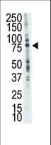 LTK Antibody (aa42-72)