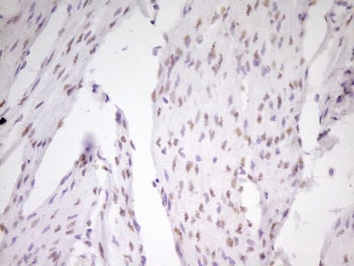 MEF2D Antibody (aa1-282, clone OTI1E11, Carrier-free)