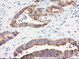 AK4 / Adenylate Kinase 4 Antibody (clone OTI5E7, Carrier-free)