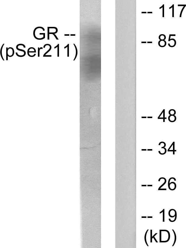 Polyclonal Rabbit anti-Human NR3C1/Glucocorticoid Receptor Antibody (phospho-Ser211, IHC, WB)