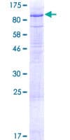 Human LSR / LISCH7 Protein (Recombinant GST)
