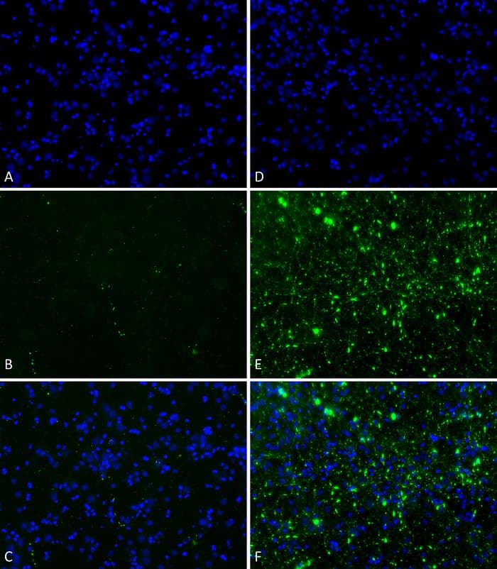 Human SNCA / Alpha-Synuclein Protein (Recombinant)