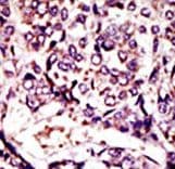 Polyclonal Rabbit anti-Human ARL1 Antibody (aa1-30, IHC, WB)