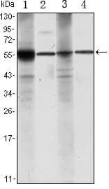 PathPlus™ Monoclonal Mouse anti-Human ALDH1A1 / ALDH1 Antibody (clone 5A11, IHC, WB)