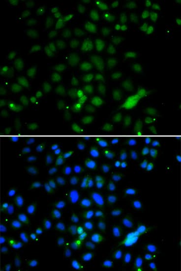Polyclonal Rabbit anti-Human ELF4 / MEF Antibody (IHC, IF, WB)