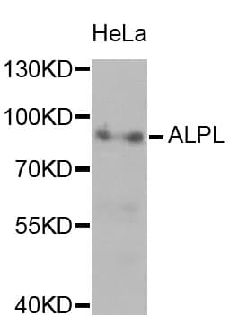 Polyclonal Rabbit anti-Human ALPL / Alkaline Phosphatase Antibody (IHC, WB)