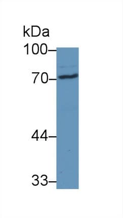 STS / ASC / Steroid Sulfatase Antibody (aa235-583)