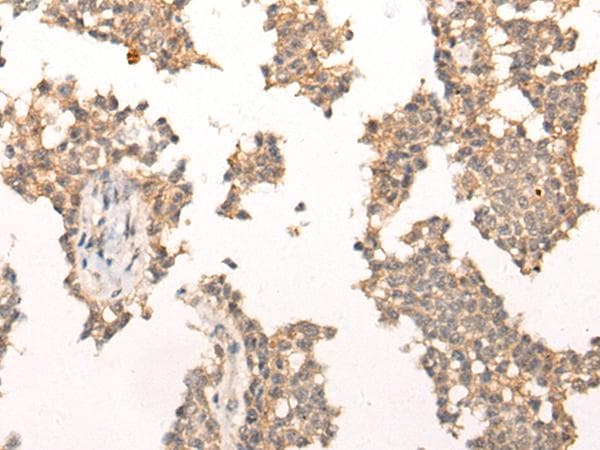Polyclonal Rabbit anti-Human PIAS3 Antibody (IHC)