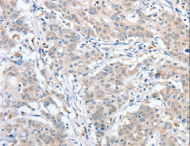 RPN1 / Ribophorin I Antibody