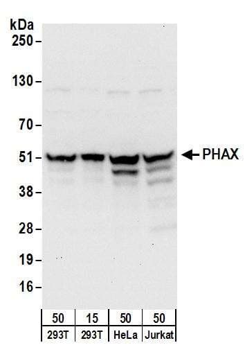 IHC-plus™ FBL / FIB / Fibrillarin Antibody (aa1-50)