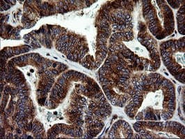 MAPK9 / JNK2 Antibody (clone OTI2H3)