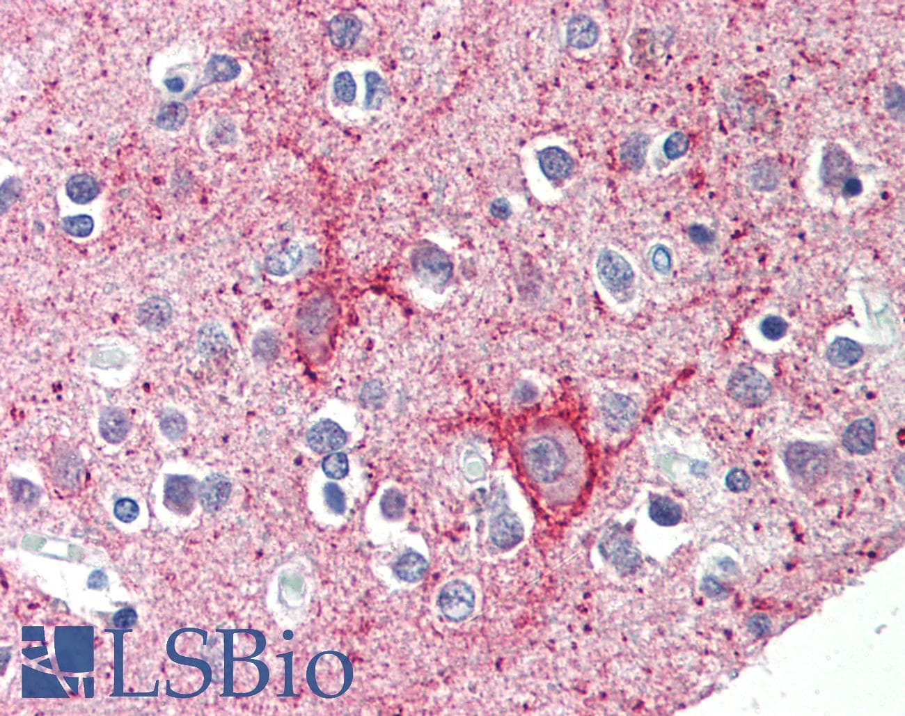 IHC-plus™ TIGAR Antibody