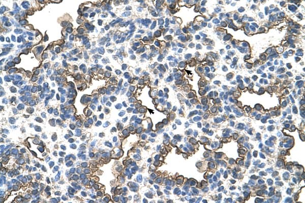 PDPN / Podoplanin Antibody (aa97-146)