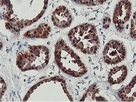 COASY Antibody (clone OTI3B3)