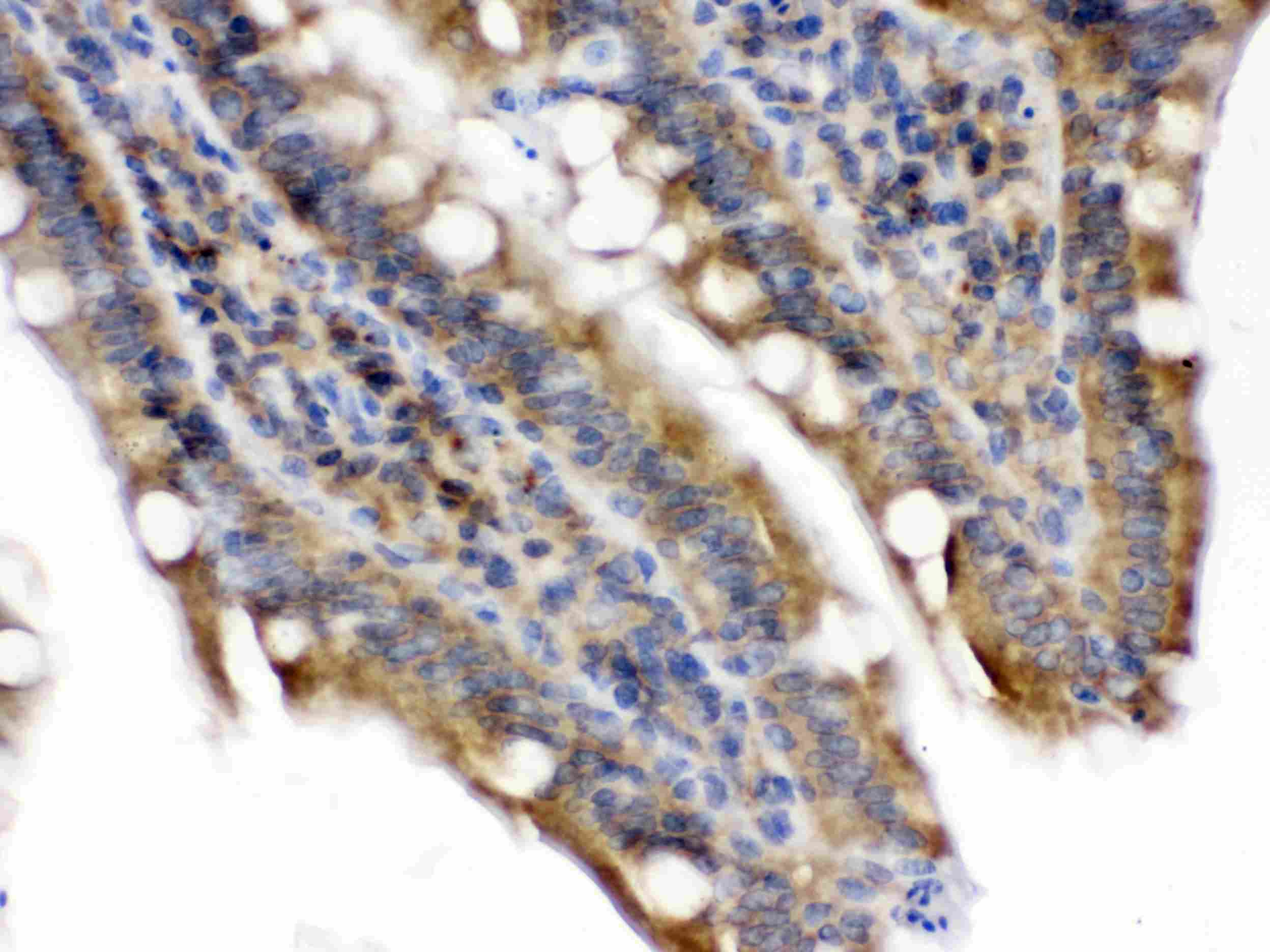 Polyclonal Rabbit anti-Human TLN2 / Talin 2 Antibody (IHC, WB)
