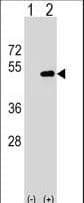 PTAR2 / FNTA Antibody (aa51-79)
