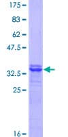 Human SLC7A1 / CAT1 Protein (Recombinant GST, N-terminus)