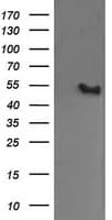 IHC-plus™ Monoclonal Mouse anti-Human MDM4 / MDMX Antibody (clone 3B9, IHC, IF, WB)