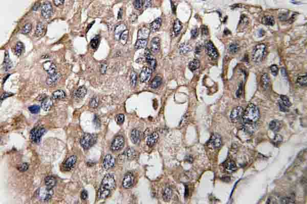 Polyclonal Rabbit anti-Human MAP3K7 / TAK1 Antibody (Asp181, IHC, WB)